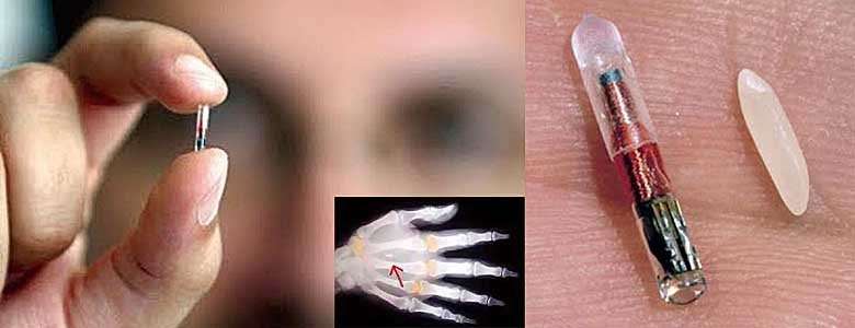 Resultado de imagen de australia microchip humanos