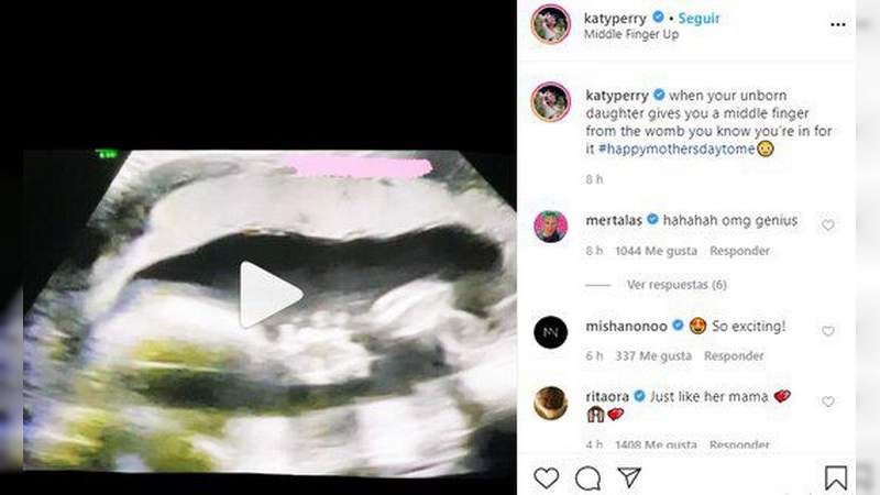 Katy Perry comparte vídeo ultrasonido de su bebé donde parece hacer la "Britney Señal" 