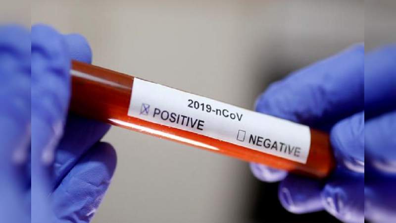 Estados Unidos da luz verde a pruebas caseras de coronavirus 