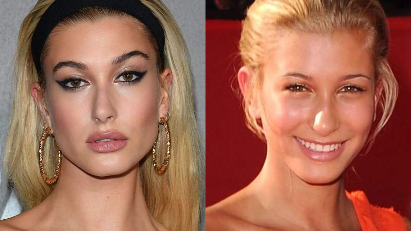 Demandará esposa de Justin Bieber a cirujano por revelar las operaciones que le ha realizado   