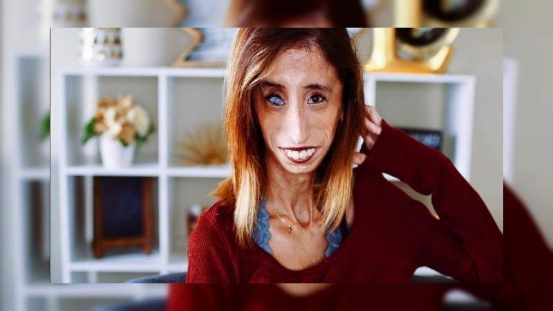  #NewTeacherChallenge es cruel y no deja nada bueno a los niños: Lizzie Velasquez 