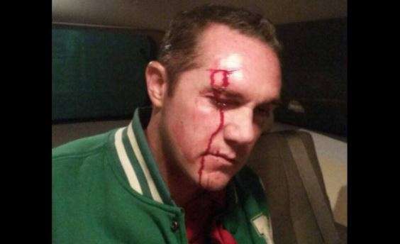 25 lesionados tras enfrentamiento entre simpatizantes del PRI y del PRD en Cuajimalpa, Distrito Federal - Foto 0 