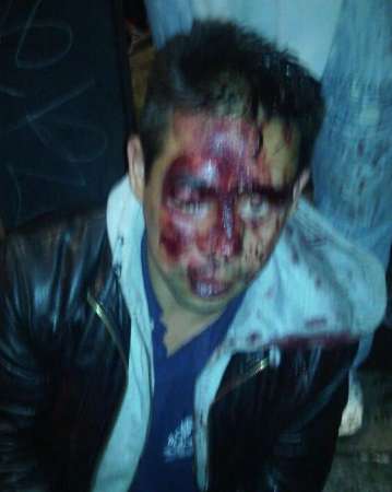 25 lesionados tras enfrentamiento entre simpatizantes del PRI y del PRD en Cuajimalpa, Distrito Federal - Foto 1 