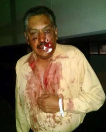 25 lesionados tras enfrentamiento entre simpatizantes del PRI y del PRD en Cuajimalpa, Distrito Federal - Foto 2 