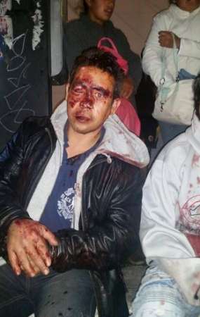 25 lesionados tras enfrentamiento entre simpatizantes del PRI y del PRD en Cuajimalpa, Distrito Federal - Foto 3 