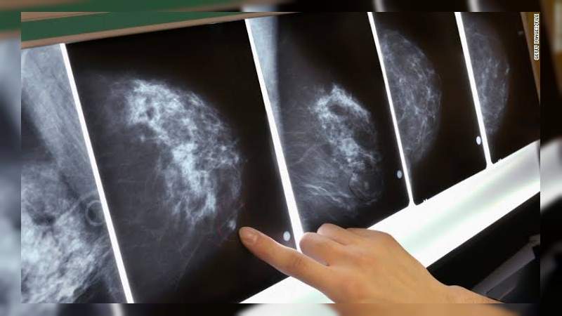 En el Día Mundial contra el Cáncer te decimos cuáles son los cánceres más comunes y mortales  