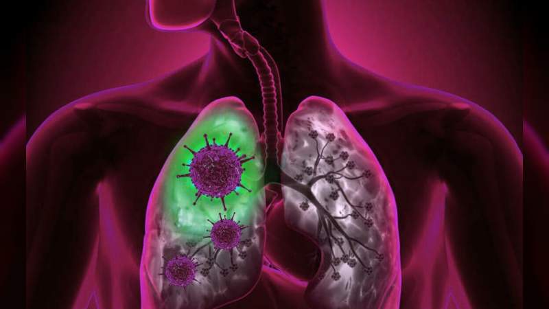 Estudio asegura que pulmones de contagiados por Covid-19 muestran más daño que el de los fumadores 