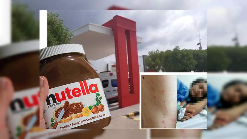 Pareja utiliza Nutella para tener sexo, pero terminan en el hospital en Colombia 