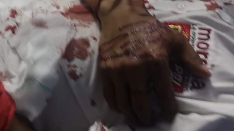 Balean a candidato de Morena en Puebla 