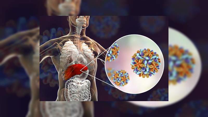 Hepatitis y sus complicaciones matan a una persona cada 30 segundos: 9 de cada 10 no sabe que tiene la enfermedad 