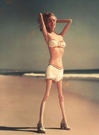 Artistas realizan Photoshop sobre el cuerpo de celebridades para crear conciencia sobre la anorexia - Foto 9 