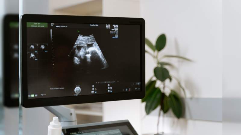 Aborto; Corte invalida la objeción de conciencia 