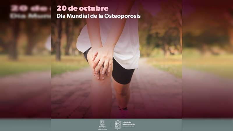 La Osteoporosis es más frecuente en mujeres que en hombres: SSM 