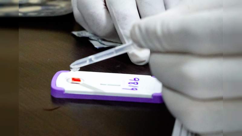 Promueve SSM diagnóstico oportuno de VIH a través de pruebas rápidas