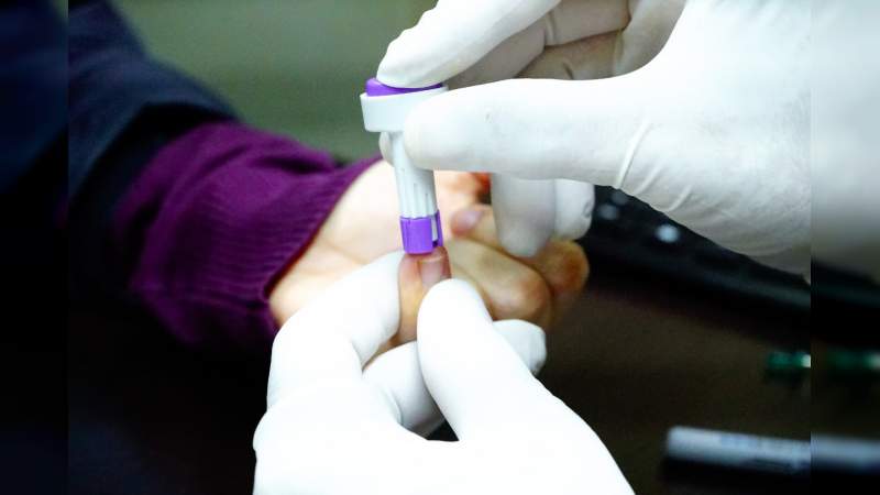 Promueve SSM diagnóstico oportuno de VIH a través de pruebas rápidas