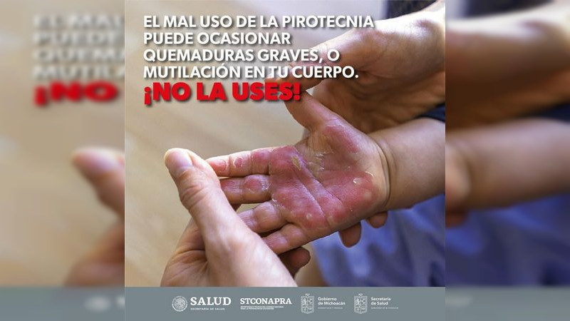 SSM invita a evitar que los niños pequeños tengan uso de pirotecnia en fiestas decembrinas 