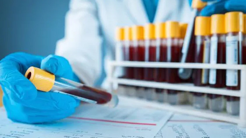 Crean test de sangre capaz de detectar cáncer y si se ha propagado 
