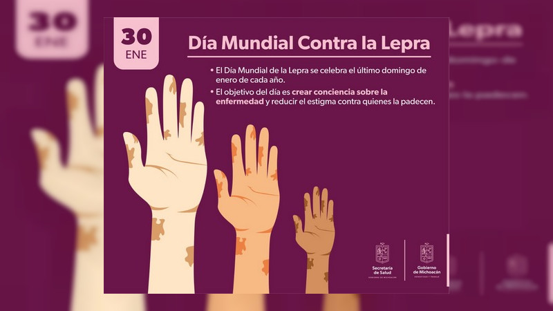 Secuelas en pacientes de lepra pueden ser evitadas con diagnóstico y tratamiento temprano: SSM 