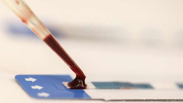 Científicos realizan experimento que podría curar el VIH 