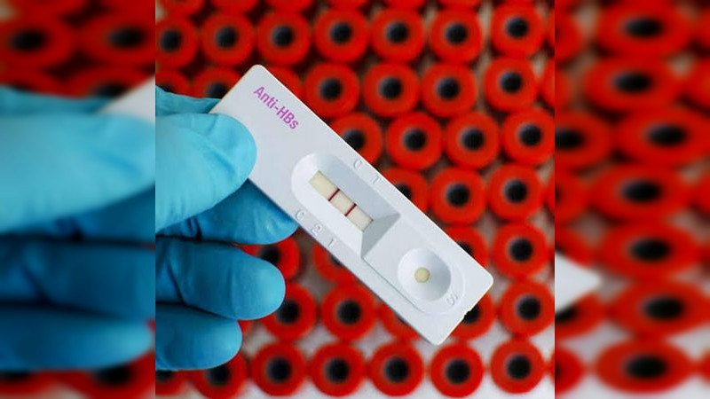 Secretaria de Salud de Michoacán, llama a la población a tomar medidas preventivas contra la prevención de hepatitis 