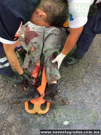 Chocan tráiler y autobús en la carretera Morelia–Charo; hay 40 heridos - Foto 4 