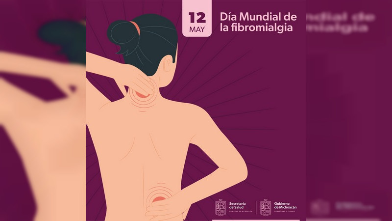 Diagnósticos oportunos de fibromialgia, mejoran la calidad de vida de los pacientes 