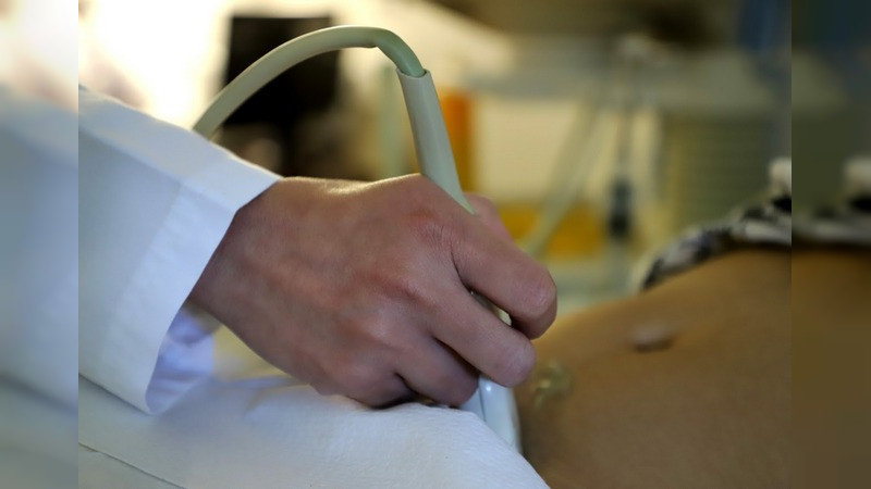 Embarazadas pueden prevenir complicaciones con su control prenatal: SSM