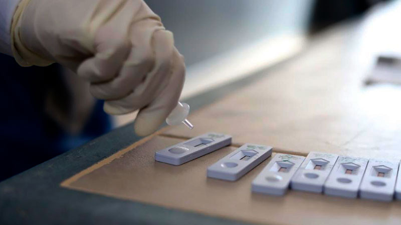 Mantiene SSM servicio de pruebas COVID-19 en Morelia 