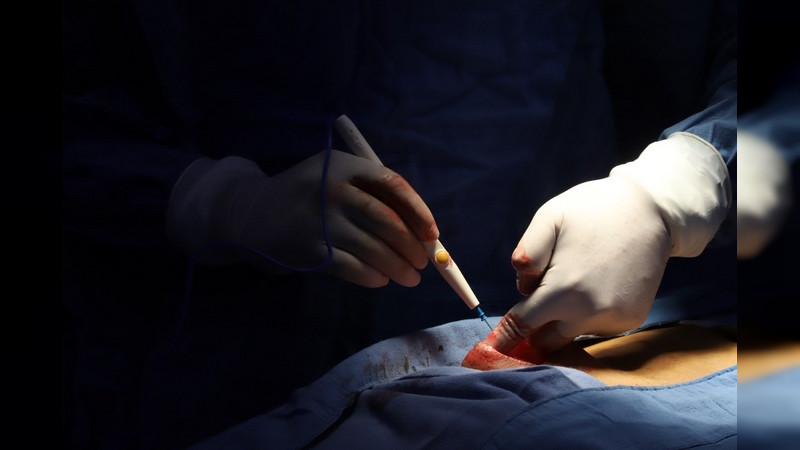 Alerta SSM por clínicas que ofertan procedimientos quirúrgicos fuera de norma 