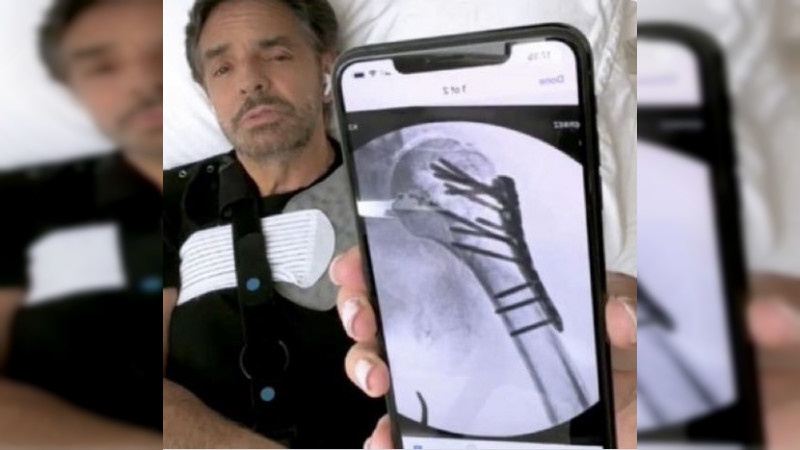 Relata Eugenio Derbez accidente que lo llevó al hospital: Cayó de 100 pisos en edificio virtual y por escaleras en la realidad  