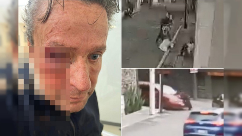 CDMX: Golpean a Alfredo Adame por grabar a baleado en Tlalpan