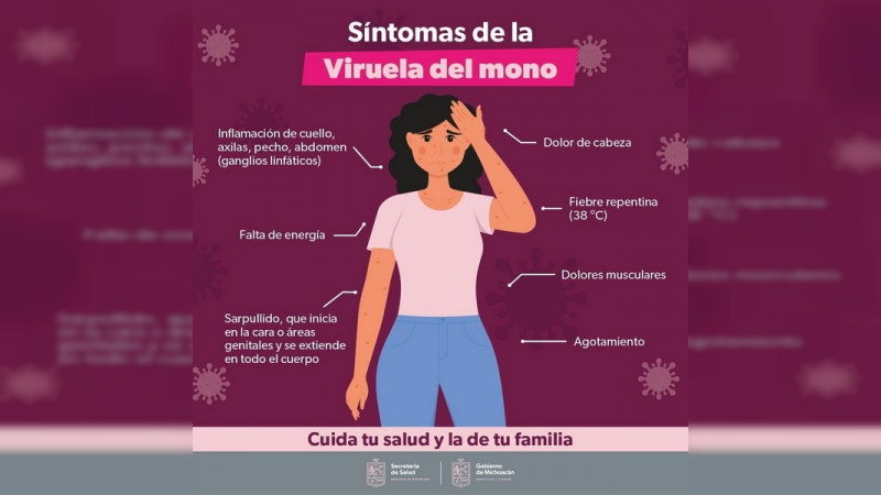 Confirma SSM 4 casos positivos de viruela símica en Michoacán