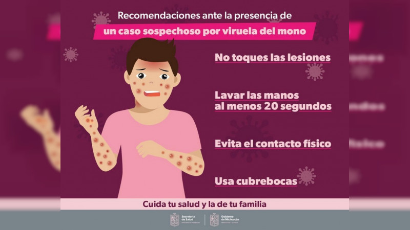 Confirma SSM 4 casos positivos de viruela símica en Michoacán