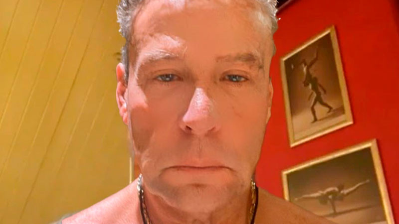 Alfredo Adame será operado por cuatro fracturas de su cara 