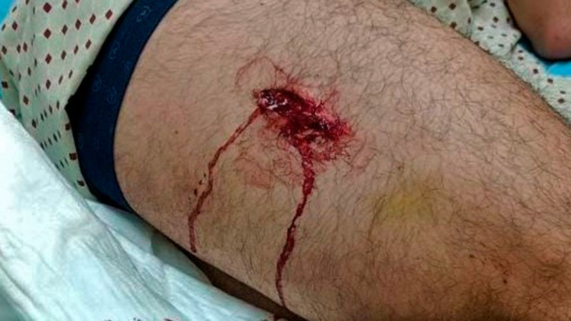 Isaac Fonseca, cornada de 2 trayectorias; estará listo para su encerrona