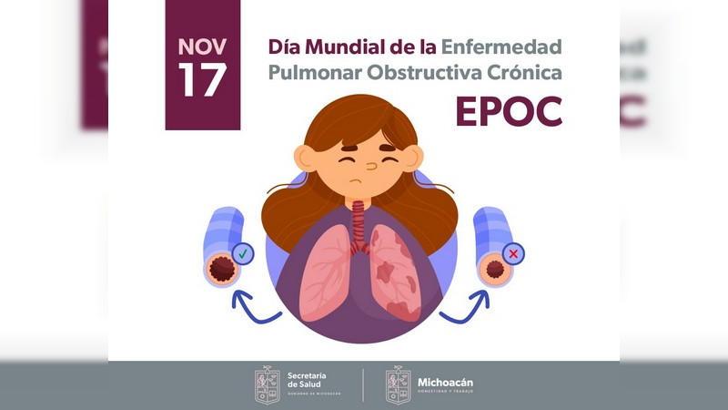 Tabaquismo, principal factor de riesgo para desarrollar EPOC: Secretaría de Salud de Michoacán  