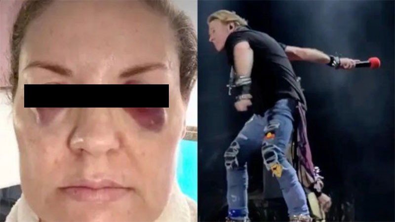 Axl Rose noquea a fan durante concierto 