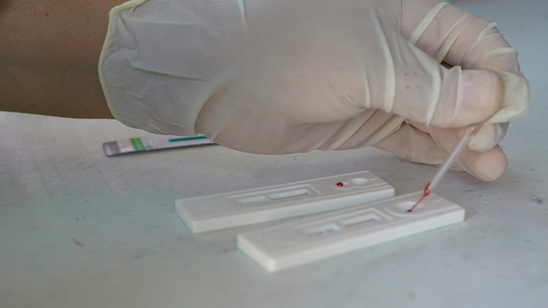Brinda la Secretaría de Salud de Michoacán detección y tratamiento gratuito a pacientes con hepatitis C