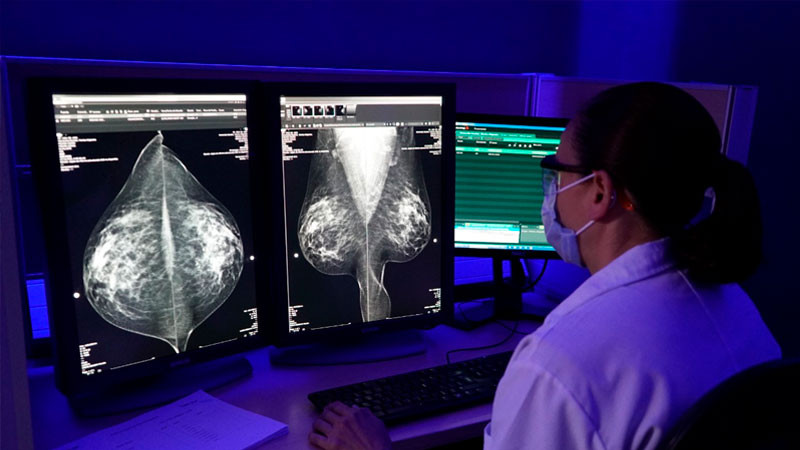 Más de 20 mil mastografías realizó la Secretaría de Salud de Michoacán durante 2022 