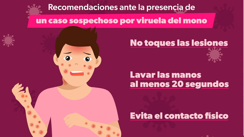 Continúa habilitada línea telefónica para orientación sobre la viruela símica 