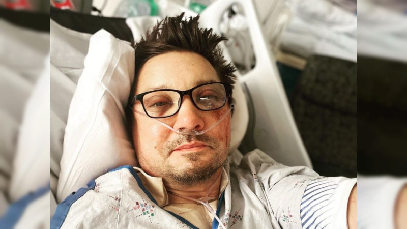 Operan a Jeremy Renner por traumatismo torácico, definen su estado como “crítico pero estable”   