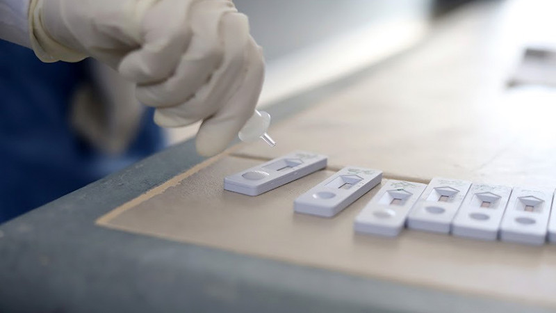 Secretaría de Salud con abasto de pruebas para la detección del COVID-19