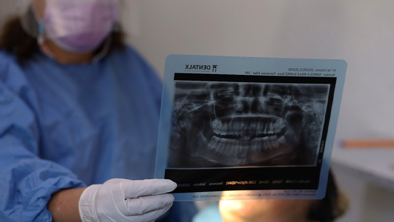 Centro de Salud de Morelia brinda atención odontológica gratuita  