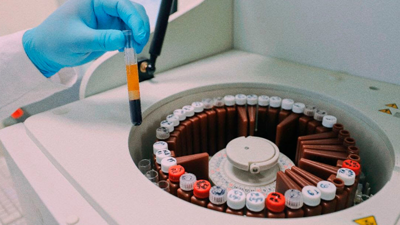 Cáncer, enfermedad tratable que puede ser curable: Javier Ávila 