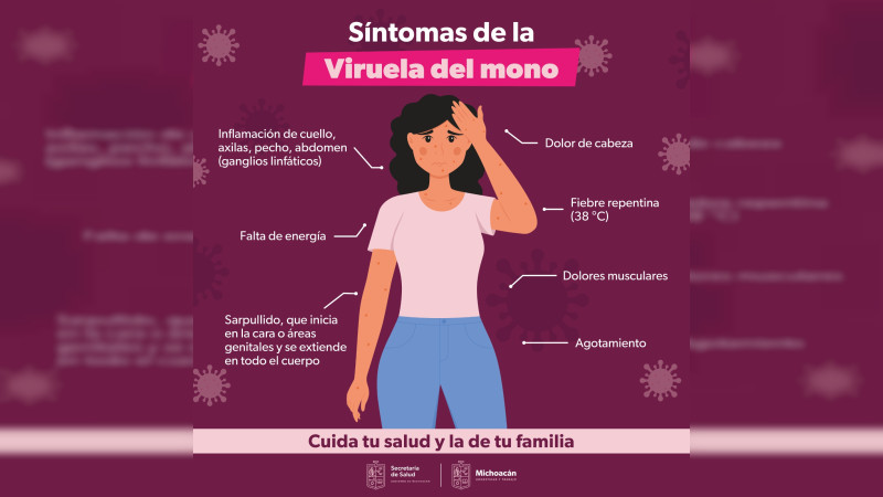 Invita SSM a solicitar información sobre la viruela símica 