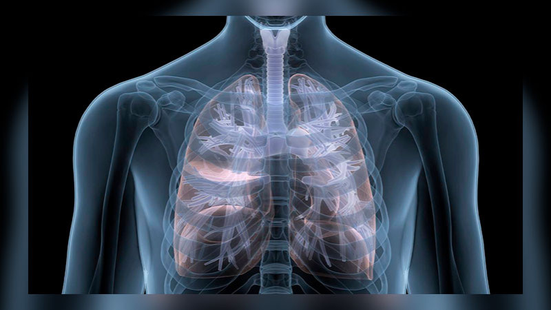 Esperanza para pacientes con fibrosis pulmonar, con la llegada de una nueva terapia en México 