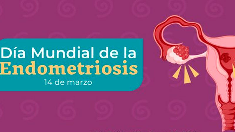 En México, una de cada 10 mujeres en edad reproductiva puede padecer endometriosis 