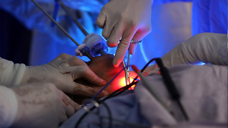 Implementa SSM nueva cirugía para tratar cáncer de tiroides 