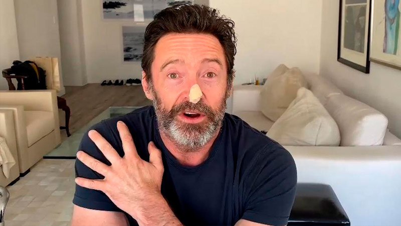 Hugh Jackman se somete a nuevo tratamiento ante el riesgo de cáncer de piel 