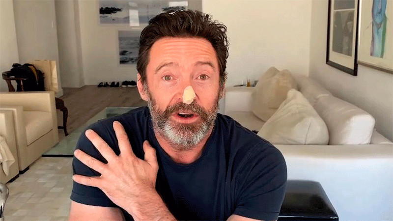 El actor Hugh Jackman continúa luchando contra el cáncer de piel 